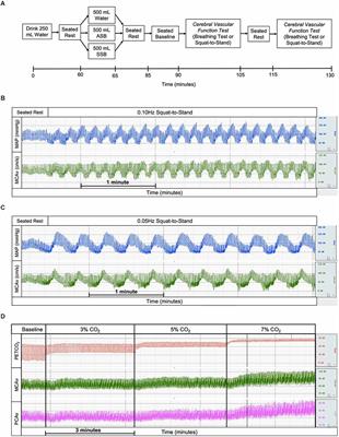 Cerebral vascular function following the acute consumption of caffeinated artificially- and sugar sweetened soft drinks in healthy adults